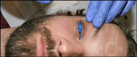 Eyeballtattooing