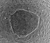 687pxhuman_embryonic_stem_cell_colo