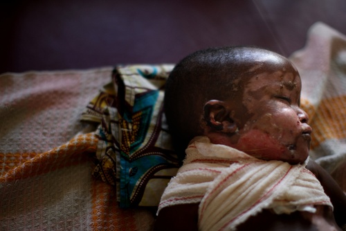 Congobabyurielsinaiafpgetty