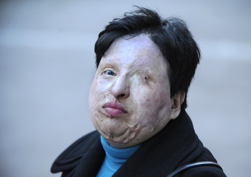 Bahramilluisgeneafpgetty Bahramilluisgeneafpgetty