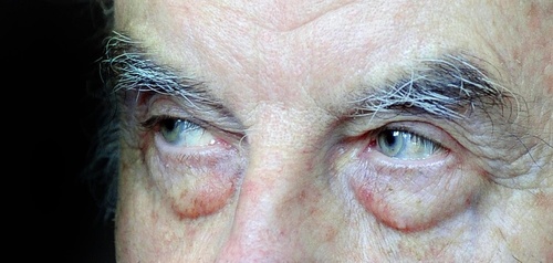 Fritzleyesapahandoutgetty