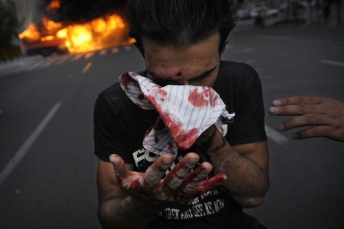 IRANBLOODOlivierLaban-Mattei:AFP:Getty