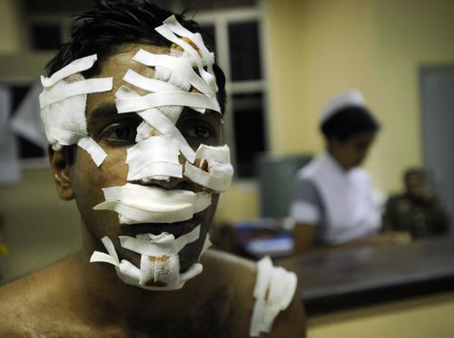 TAMILVICTIMIsharaS.Kodikara:AFP:Getty