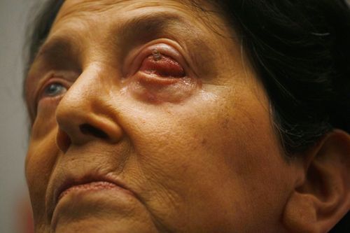 TOOTHEYEJoeRaedle:Getty