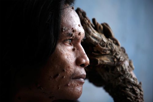 DedeKoswaraUletIfansastiGettyImages