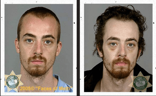 Meth-face9