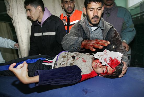 GAZACHILDAbidKateb:Getty