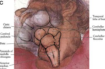 6a00d8341c562c53ef0133ef5efbdf970b-800wi