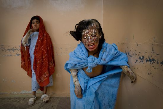 WOUNDEDPaulaBronstein:Getty