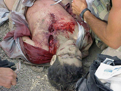 Omar_Khadr_getting_battlefield_first_aid