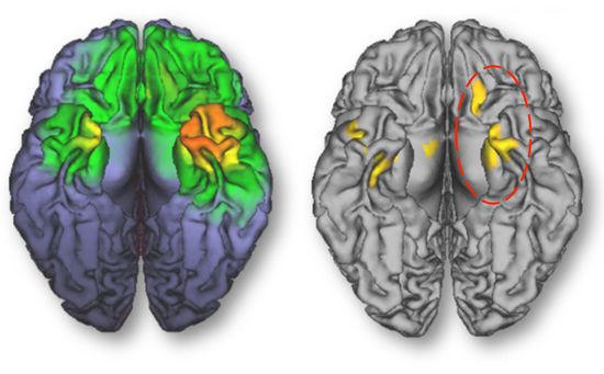 Brain-scan-cell-phone-jama
