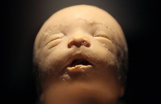 19FETUSBLeonNeal:Getty