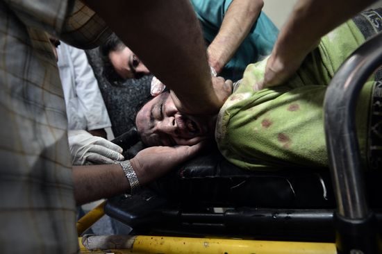 Syria_Wounded_Man_GT Syria_Wounded_Man_GT