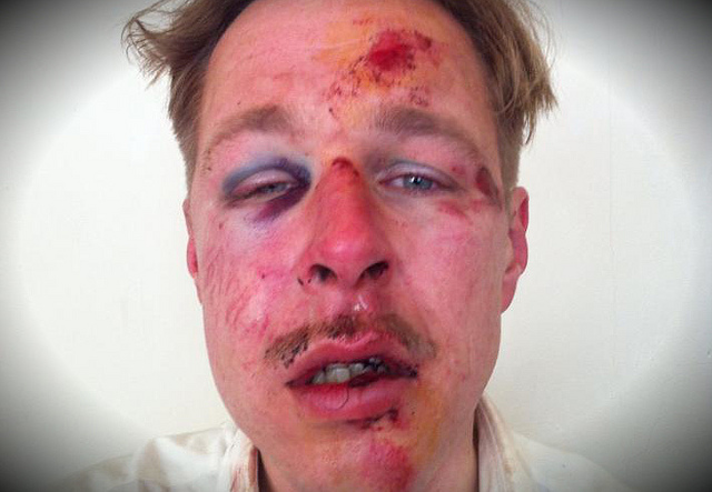 Gay-man-severely-beaten-by-Muslims-in-Paris