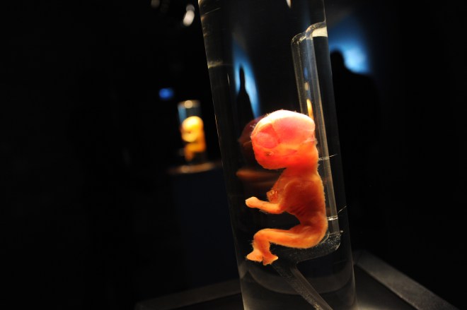 A 19 weeks old fetal bone development is