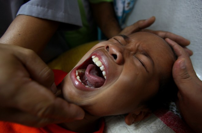 A boy shouts as he under goes circumcisi