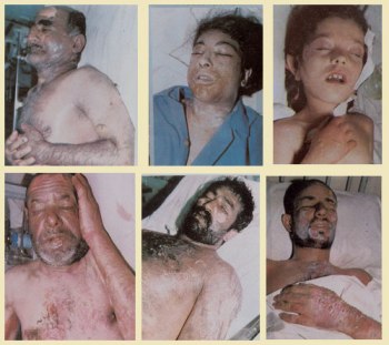 Chemical Weapons Iraq-Iran War