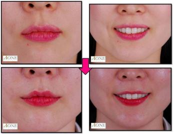 Smile Plastic Surgery