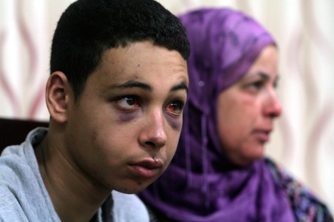 Mahmoud Abbas receives Mohammed Abu Khdeir's family