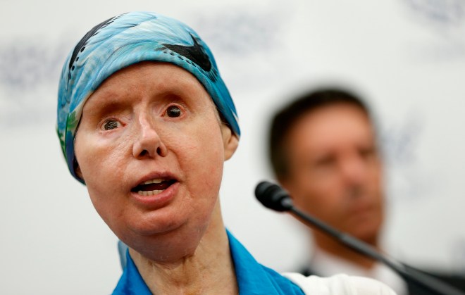 Chimp Attack Victim Lobbies On Capitol Hill To Ban Trade Of Primates As Pets