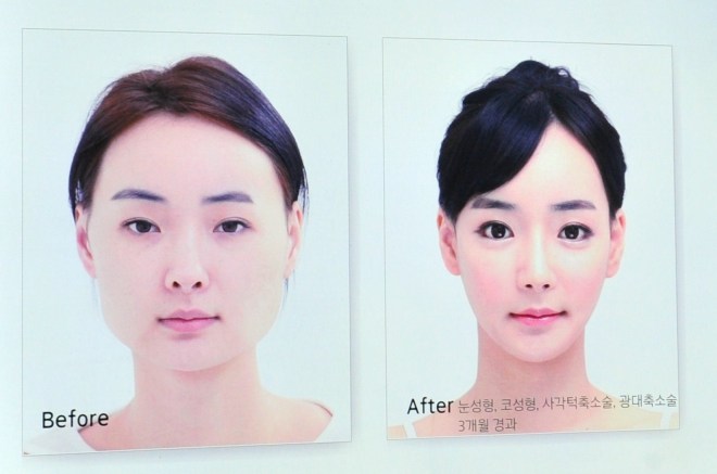 SKOREA-HEALTH-SURGERY-ADVERTISEMENT-LIFESTYLE