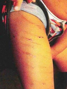 f739cac8_adrian-peterson-child-abuse-4