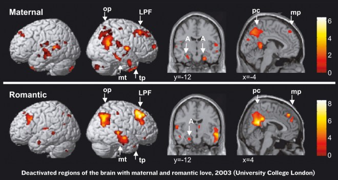 UCL-neurology-maternal-vs-romantic-love